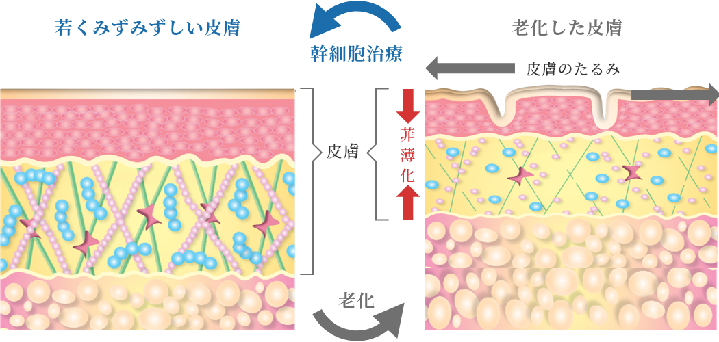 皮膚の若返りのイメージ